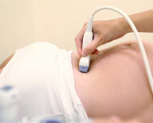 孕期香港验血需要复查,试管婴儿备孕经验 升级为双胞胎妈妈