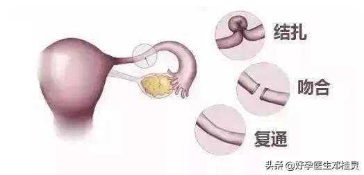 香港邮寄验血需要注意什么意思,备孕要检查输卵管吗