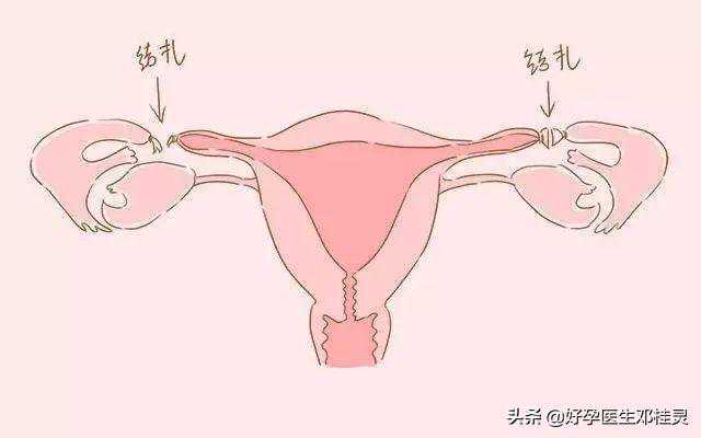 香港邮寄验血需要注意什么意思,备孕要检查输卵管吗
